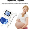 Fetal heart rate monitoring